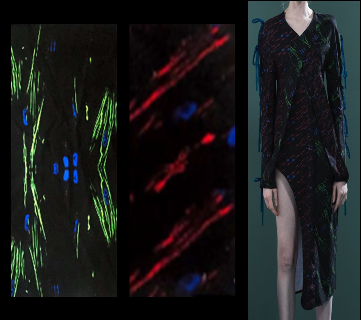 Fashion designs printed cotton material, and dresses made using histologic images from stem cell experiments by Zhu He (Irene)